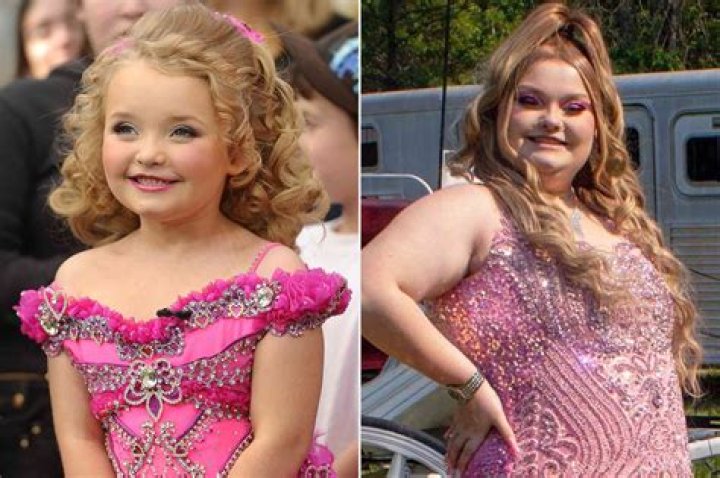 A Eugene Briggs Honey Boo Boo Sister Anna Cancer