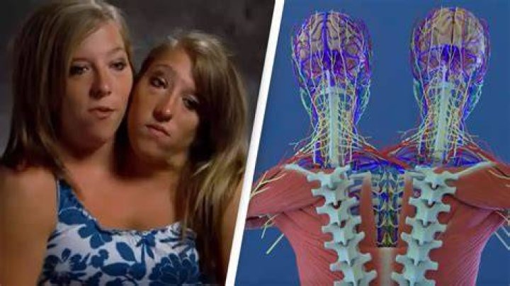 Abby and Brittany Hensel Game Shows Wiki Fandom