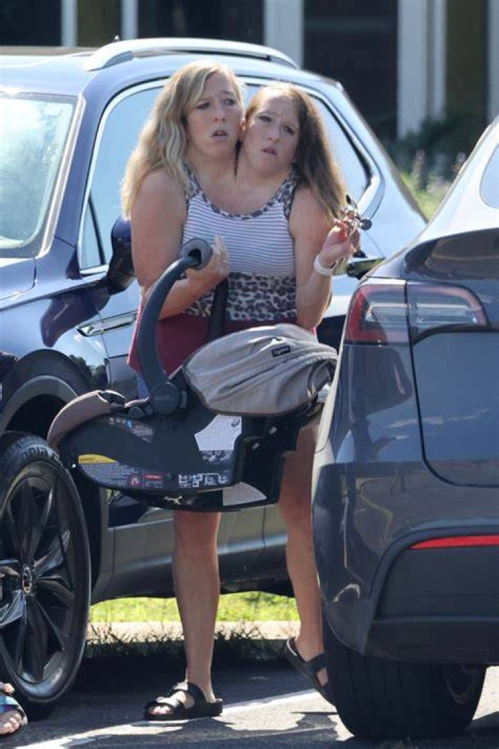Abby and brittany hensel today acetobrazil