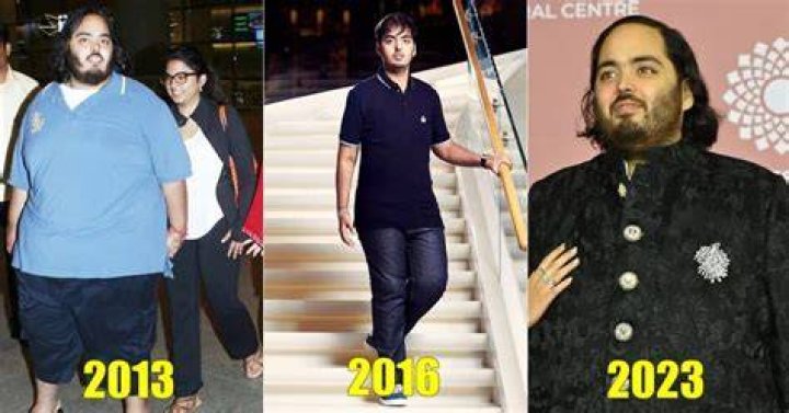 Did Anant Ambani Undergo Weight Loss Surgery Or Not? Health Condition