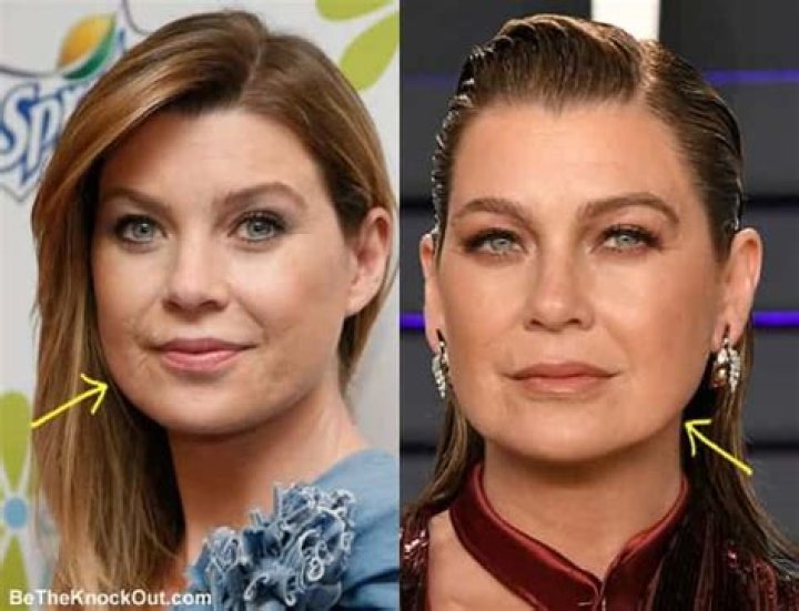 Did Ellen Pompeo Get Plastic Surgery? Transformation in Photos Closer