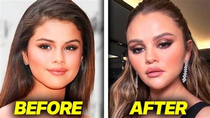 Fans Think Selena Gomez Had &lsquo;Cat Eye Surgery&rsquo; After Her Appearance At
