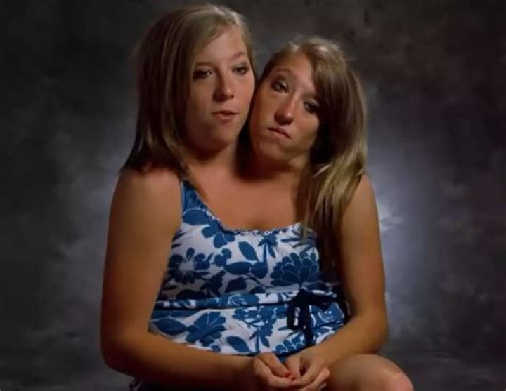 Here&rsquo;s What Conjoined Twins Abby And Brittany Hensel Look Like Today