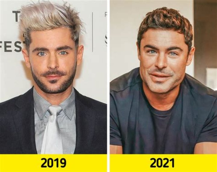 &iexcl;Qu&eacute; le pas&oacute;! Zac Efron explica por qu&eacute; su cara luce 'irreconocible