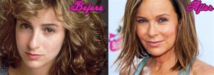 Jennifer Grey Revealed Her Nose Job Did Not Ruin Her Hollywood Career