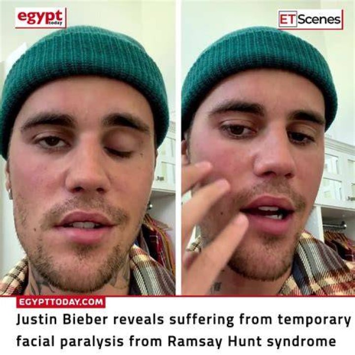 Justin Bieber Reveals He&rsquo;s Battling Lyme Disease