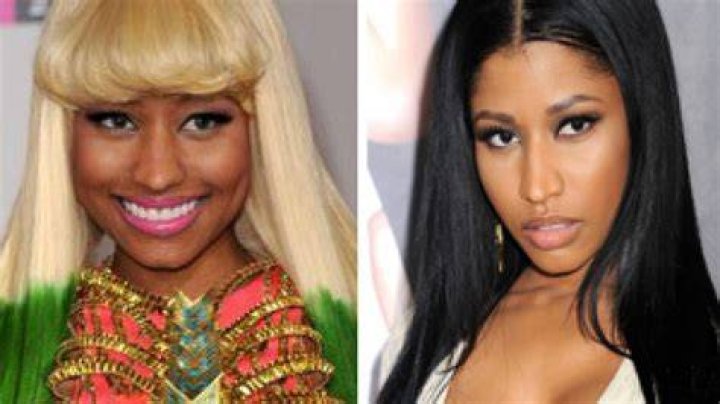 Nicki Minaj Before And After Skin Bleaching
