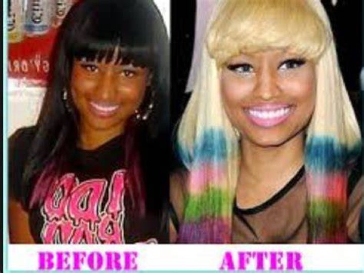 Nicki Minaj Skin Lightening