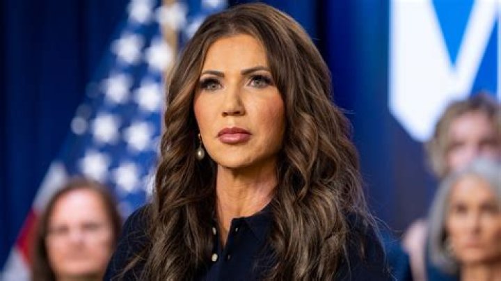 PHOTO Kristi Noem Recently Got More Face Injections To Improve Her