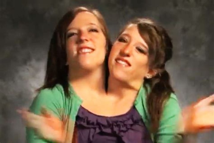 Rare Conjoined Twins Abby and Brittany Share Their Exciting News With