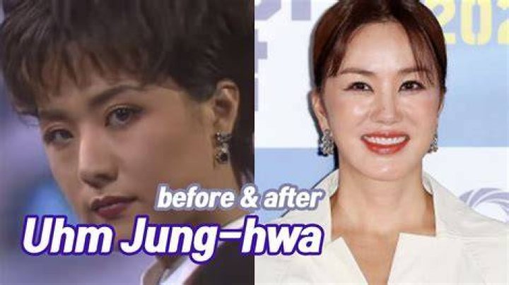 Uhm Jung Hwa Plastic Surgery Uhm JungHwa Before And After 모든 답변 Ro